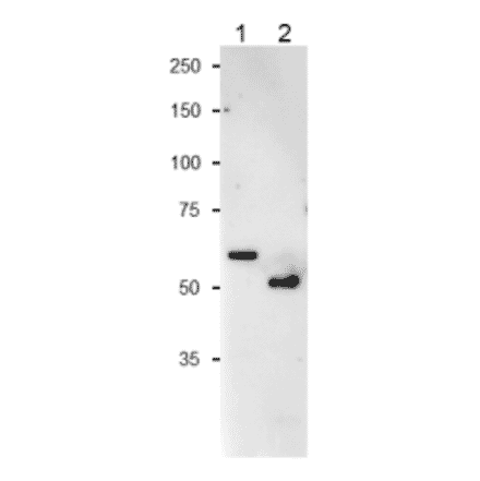 Western Blot of NiR protein of Cyanobacterium and Spinacch