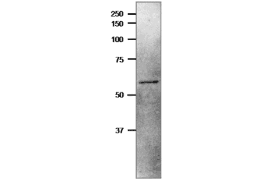 Western Blot of NiR protein in crude extrant of Cyanobacterium, Synechocystis sp,
