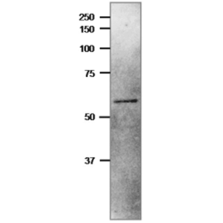 Western Blot of NiR protein in crude extrant of Cyanobacterium, Synechocystis sp,