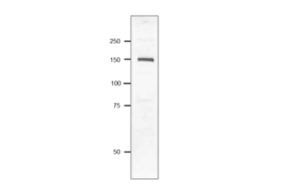 Western blot of P. multocida Toxin.