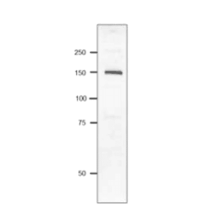 Western blot of P. multocida Toxin.