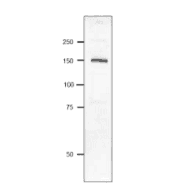 Western blot of P. multocida Toxin.