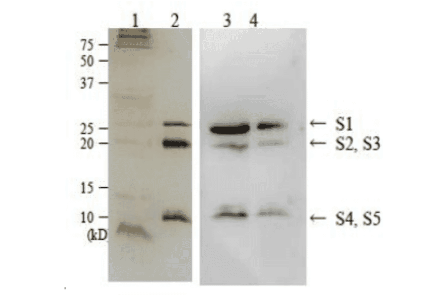 Detection of perussis toxin in culture medium of Bordetera pertussis strain Tohama by Western blotting using anti-perussis toxin antibody.