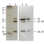 Detection of perussis toxin in culture medium of Bordetera pertussis strain Tohama by Western blotting using anti-perussis toxin antibody.