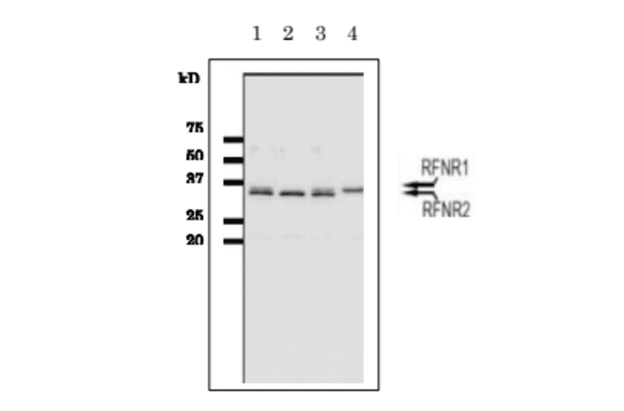 Detection of Arabidopsis R-FNR1 and R-FNR2 isoproteins by western blotting with anti-R-FNR antibody