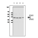 Detection of Arabidopsis R-FNR1 and R-FNR2 isoproteins by western blotting with anti-R-FNR antibody