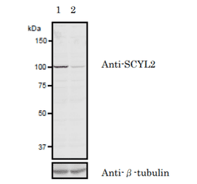 Validation of the anti-SCYL2 antibody with siRNA.in western blotting
