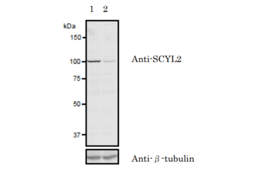 Validation of the anti-SCYL2 antibody with siRNA.in western blotting