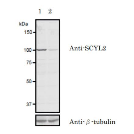 Validation of the anti-SCYL2 antibody with siRNA.in western blotting