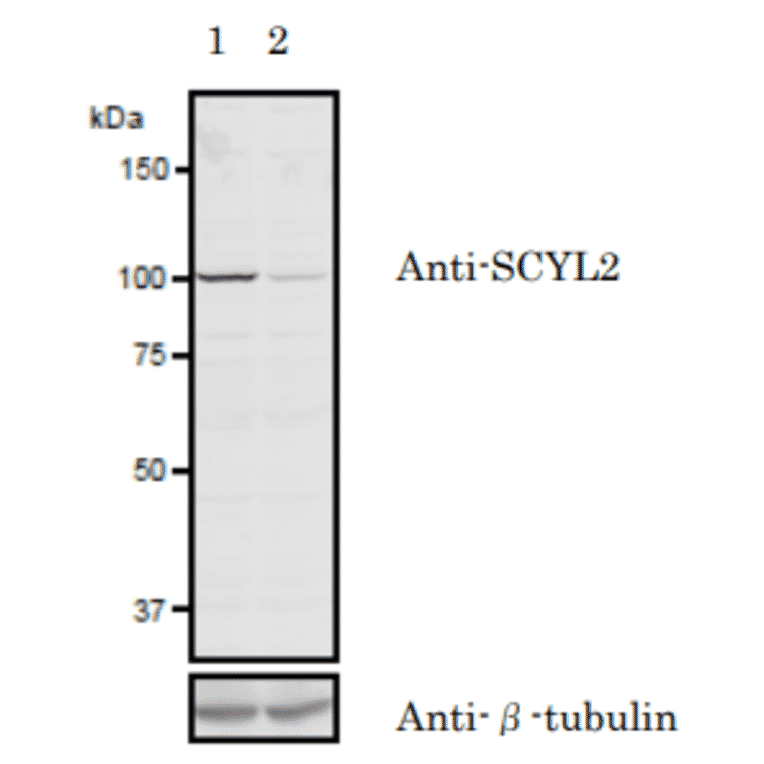 Validation of the anti-SCYL2 antibody with siRNA.in western blotting