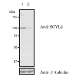 Validation of the anti-SCYL2 antibody with siRNA.in western blotting