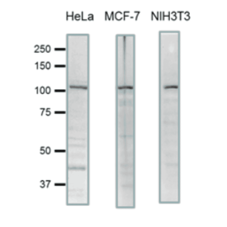 Detection of endogenous levels of SCYL2 in human and mouse cell extracts by western blotting.