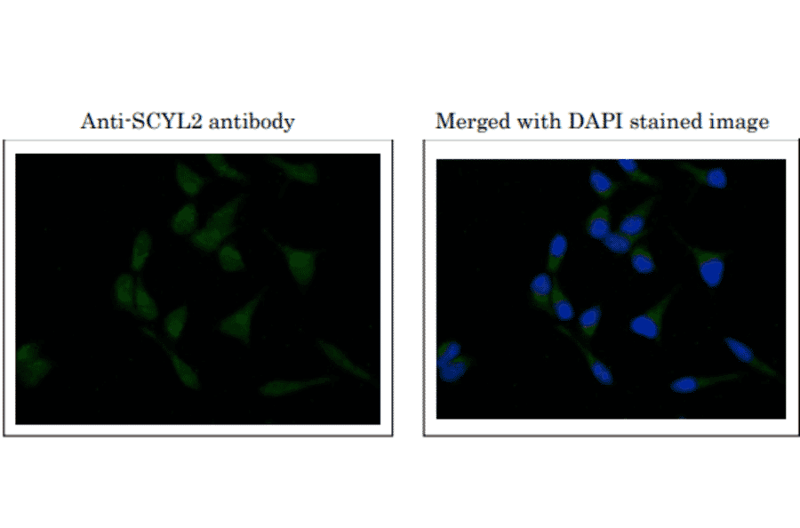 Immunofluorescence staining of SCYL2 in MCF7 cells.