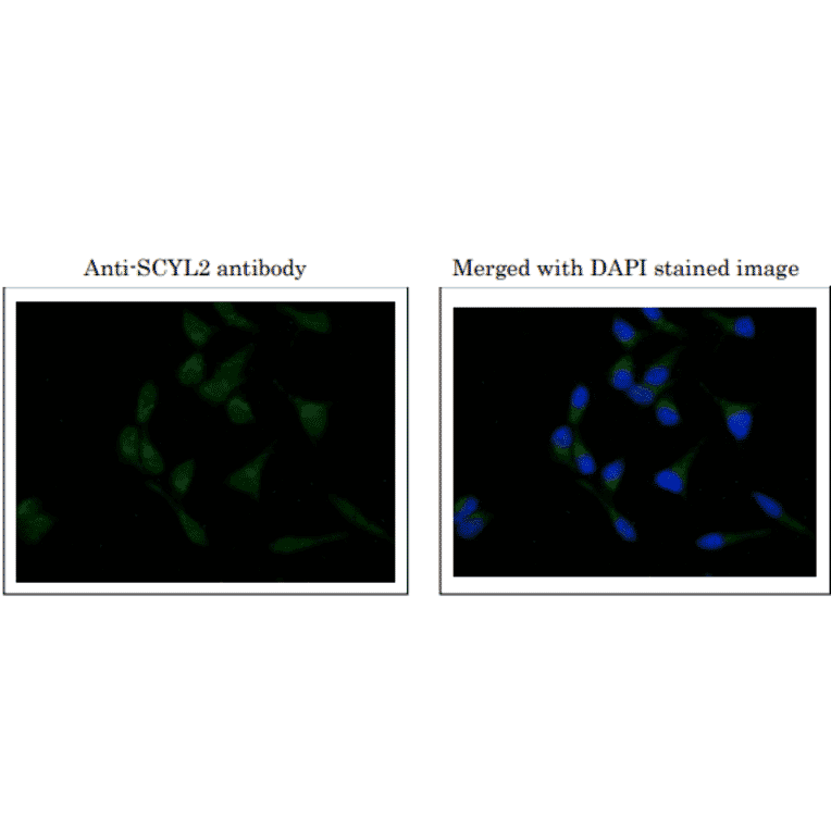 Immunofluorescence staining of SCYL2 in MCF7 cells.