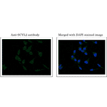 Immunofluorescence staining of SCYL2 in MCF7 cells.