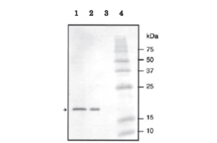 Identification of NADase inhibitor in crude extracts by western blotting with anti NADase inhibitor antibody. 
