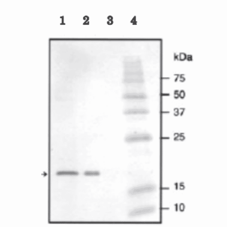 Identification of NADase inhibitor in crude extracts by western blotting with anti NADase inhibitor antibody. 