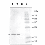 Identification of NADase inhibitor in crude extracts by western blotting with anti NADase inhibitor antibody. 