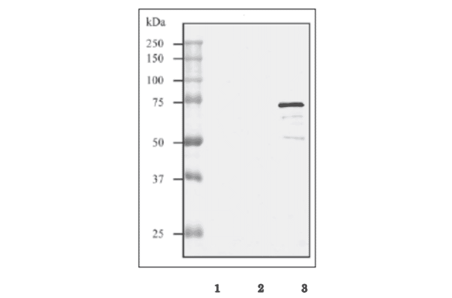 Western blot analysis of culture supernatant from GAS strain Sa and GCS strain H46A with the anti-SLO antibody.
