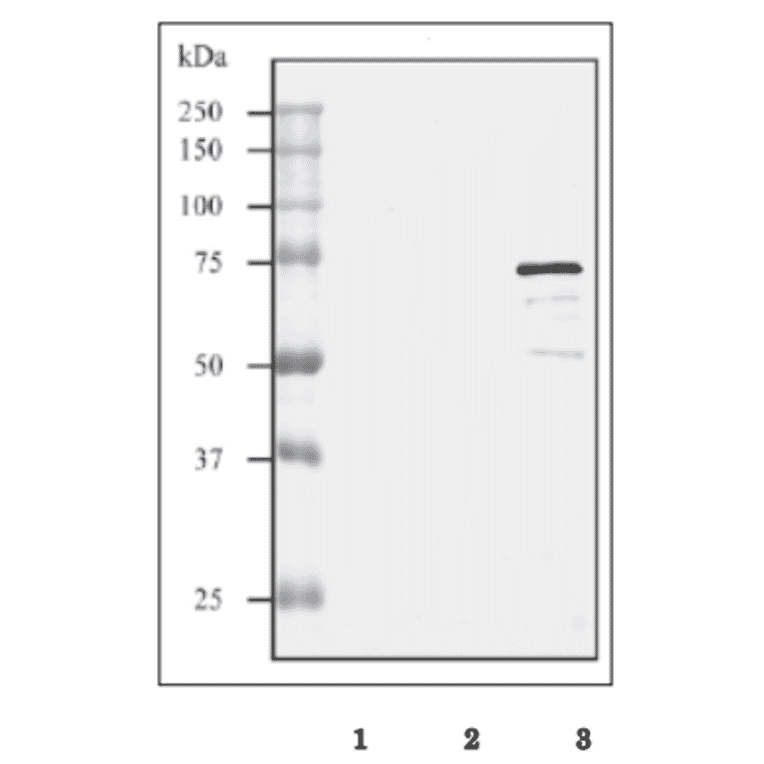 Western blot analysis of culture supernatant from GAS strain Sa and GCS strain H46A with the anti-SLO antibody.