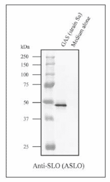 Anti-Streptolysin O Antibody (A101741) | Antibodies.com