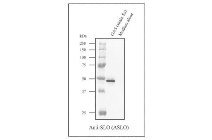 Western blot analysis of concentrated culture supernatant of GAS strain Sa with the anti-SLO antibody
