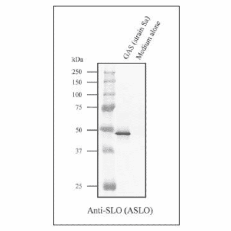 Western blot analysis of concentrated culture supernatant of GAS strain Sa with the anti-SLO antibody