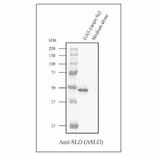 Western blot analysis of concentrated culture supernatant of GAS strain Sa with the anti-SLO antibody