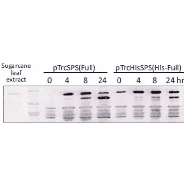 Western blot detection of SPS protein.