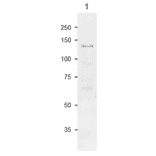 Western Blot of SPS in maize leaf extract.