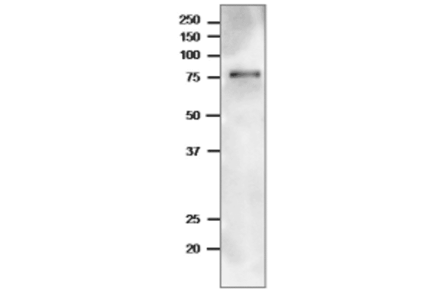 Western Blot of TGG1 in arabidopsis leaf extract.