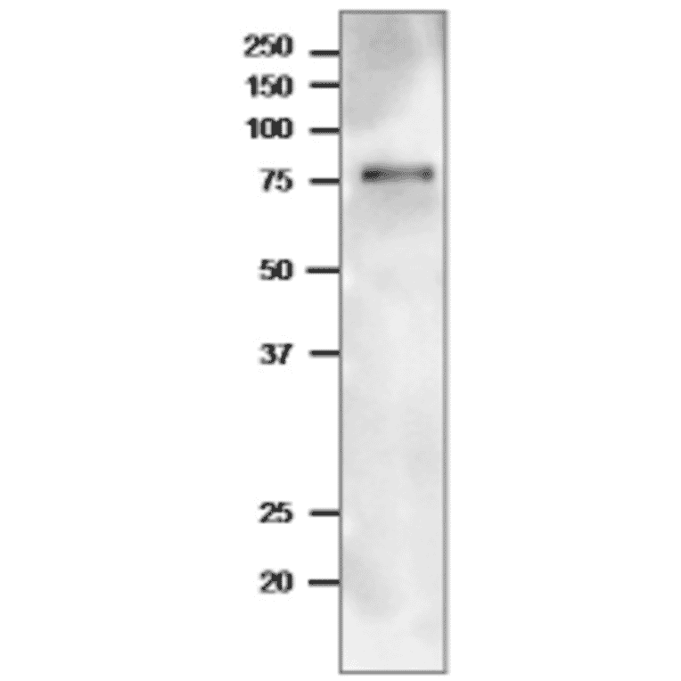 Western Blot of TGG1 in arabidopsis leaf extract.