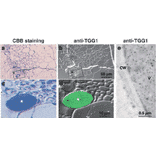 Localization of TGG1 in sections of Arabidopsis rosette leaves