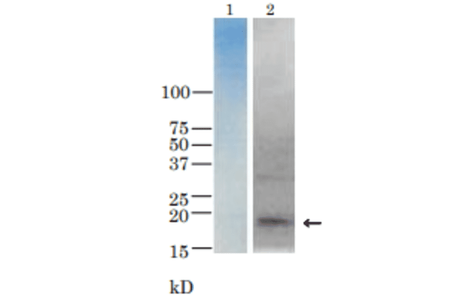 Detection of TRH toxin in the culure medium of V. parahaemolyticus (TRH+) by western blotting with anti-TRH antibody.