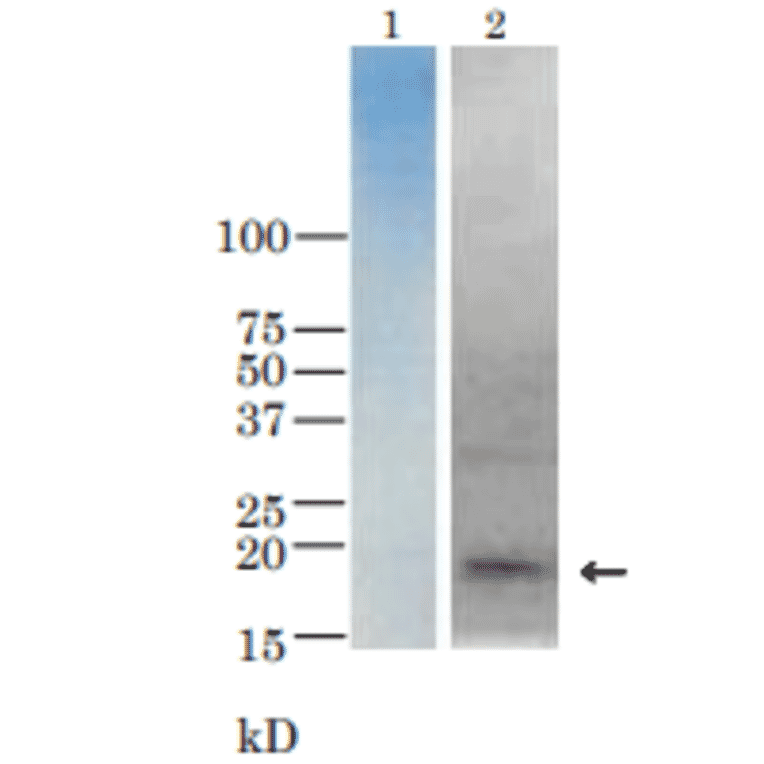 Detection of TRH toxin in the culure medium of V. parahaemolyticus (TRH+) by western blotting with anti-TRH antibody.