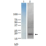 Detection of TRH toxin in the culure medium of V. parahaemolyticus (TRH+) by western blotting with anti-TRH antibody.