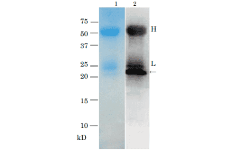 Immunoprecipitation of TRH toxin from Vibrio parahaemolyticus (TRH+) culture medium with anti-TRH antibody.