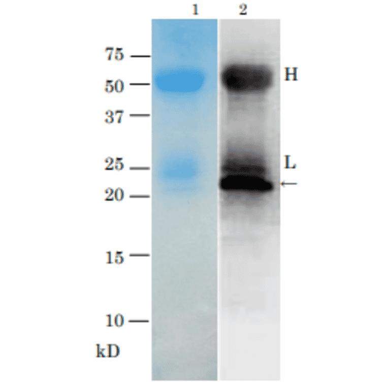 Immunoprecipitation of TRH toxin from Vibrio parahaemolyticus (TRH+) culture medium with anti-TRH antibody.