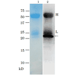 Immunoprecipitation of TRH toxin from Vibrio parahaemolyticus (TRH+) culture medium with anti-TRH antibody.