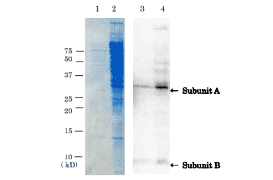 Detection of VT1 by western blotting