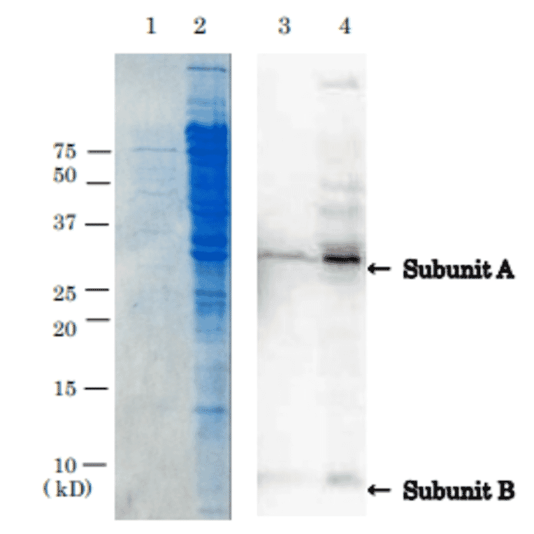 Detection of VT1 by western blotting