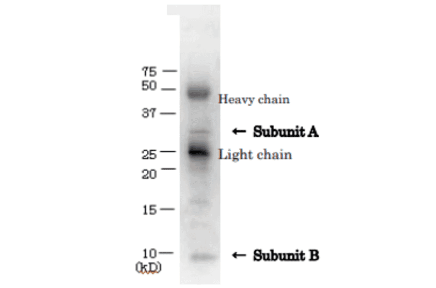 Immunoprecipitation of VT1 from culture medium of VTEC with anti-Verotoxin antibody.
