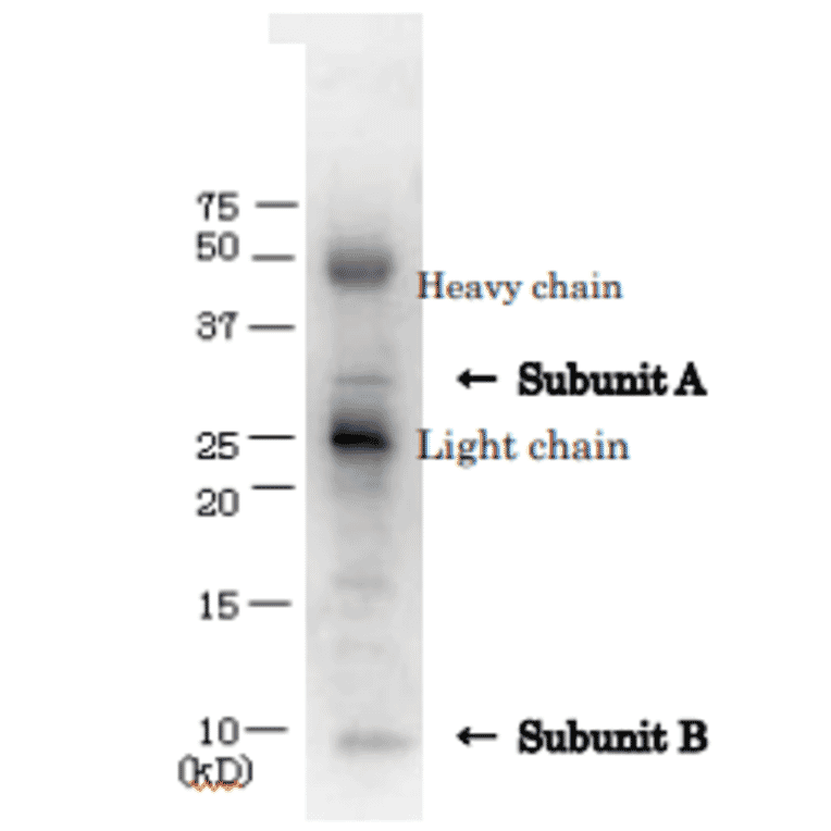 Immunoprecipitation of VT1 from culture medium of VTEC with anti-Verotoxin antibody.