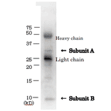 Immunoprecipitation of VT1 from culture medium of VTEC with anti-Verotoxin antibody.