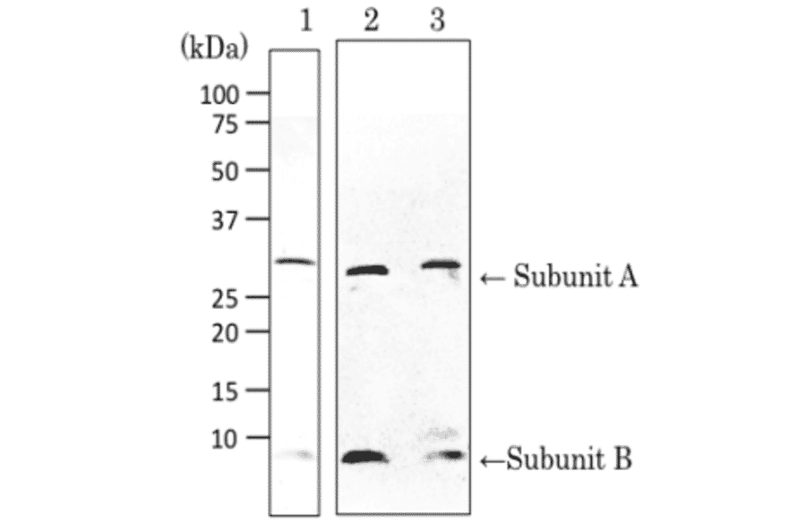 Detection of VT1 and VT2 by Western blotting with ant-Vero toxin .