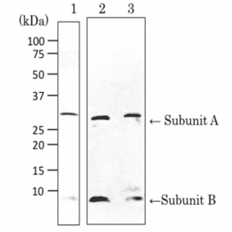 Detection of VT1 and VT2 by Western blotting with ant-Vero toxin .