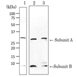 Detection of VT1 and VT2 by Western blotting with ant-Vero toxin .