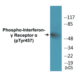 Western Blot - Interferon gamma Receptor alpha (phospho Tyr457) Cell Based ELISA Kit (CBP1383) - Antibodies.com