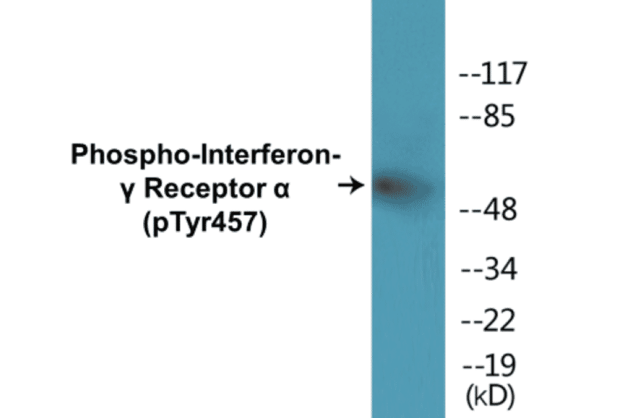 Western Blot - Interferon gamma Receptor alpha (phospho Tyr457) Cell Based ELISA Kit (CBP1383) - Antibodies.com
