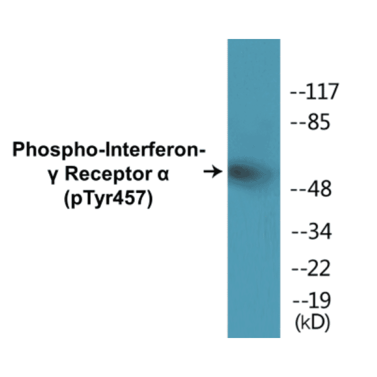 Western Blot - Interferon gamma Receptor alpha (phospho Tyr457) Cell Based ELISA Kit (CBP1383) - Antibodies.com